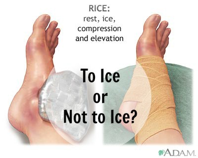 To Ice or Not to Ice?