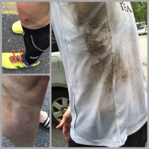 Bryan Falchuk - injury post run - 300x300