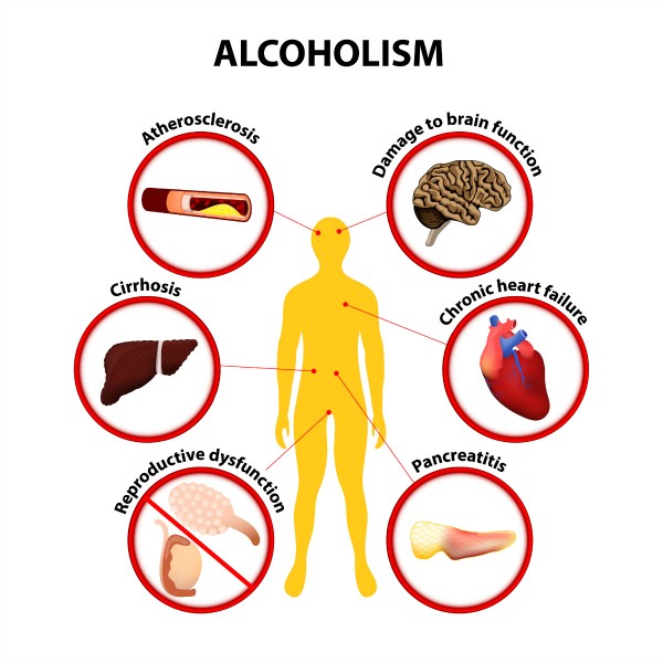health effects of alcoholism infographic