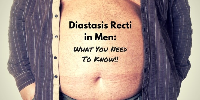 Diastasis Recti What You Need To Know