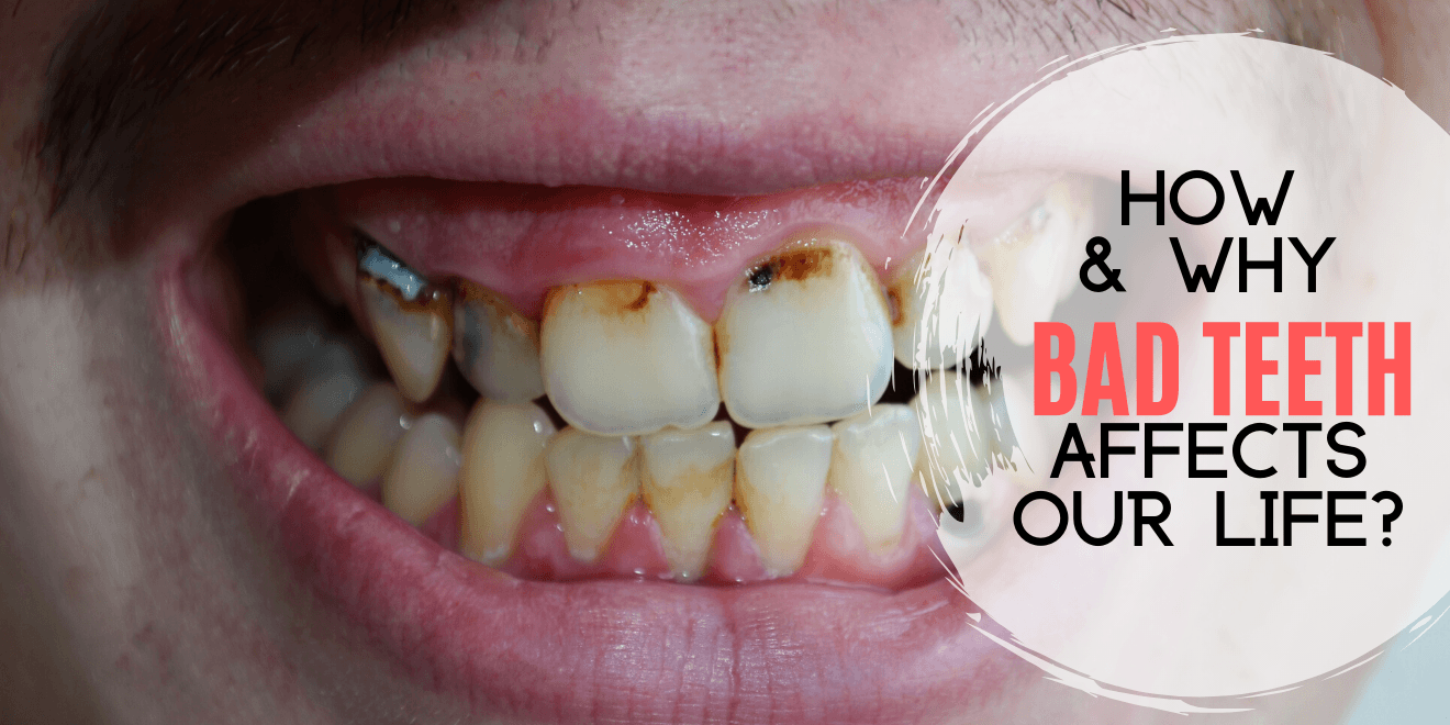 How and Why Bad Teeth Affects Our Life?