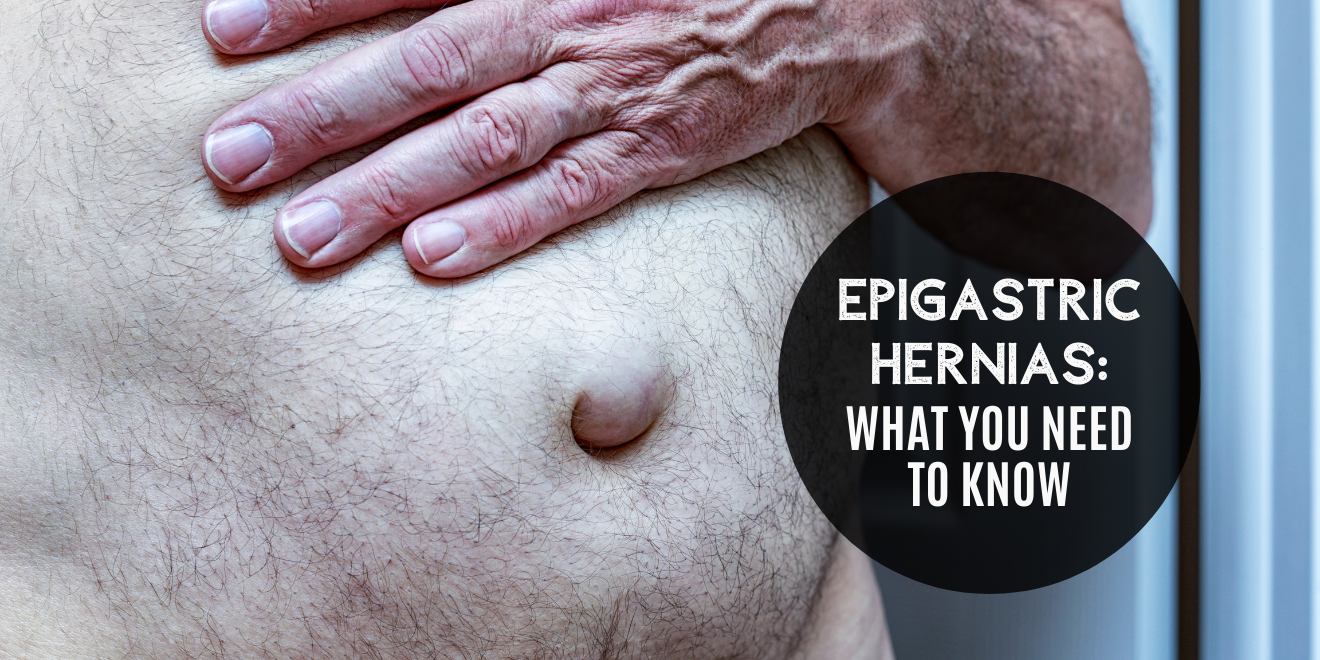 An Overview of Epigastric Hernia and How to Treat It